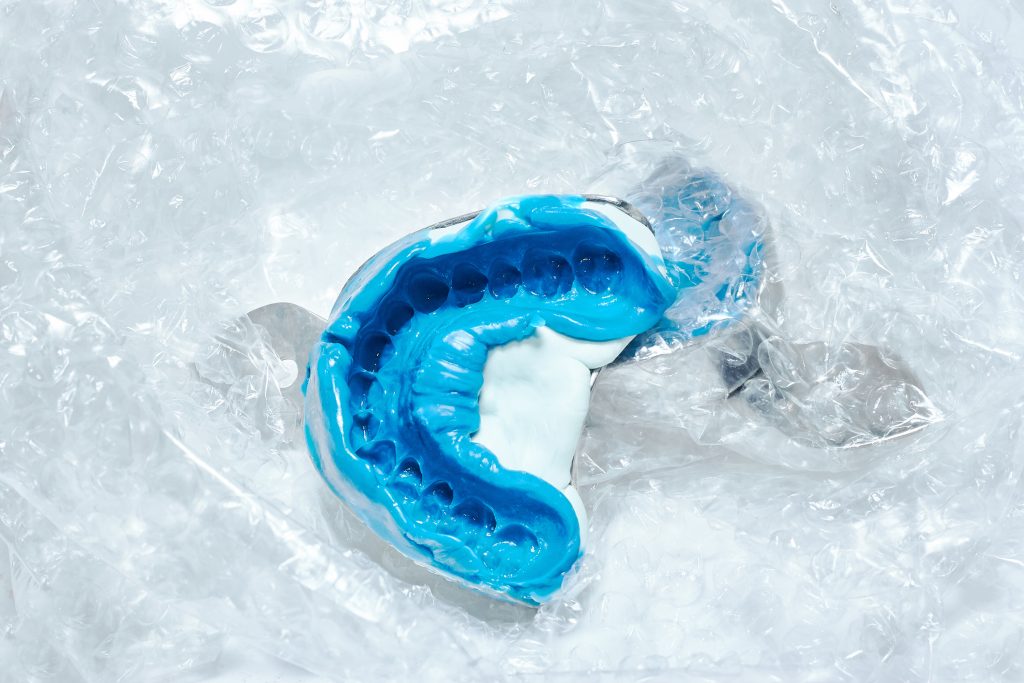 impressões tradicionais ou impressões 3D na medicina dentária